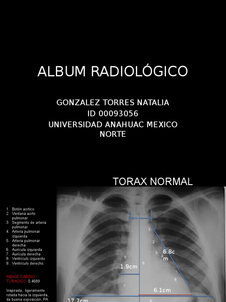 Album Radiográfico Rotación de Cardiología. | PDF | Aorta | Pulmón