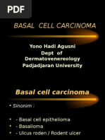 Basal Cell Carcinoma