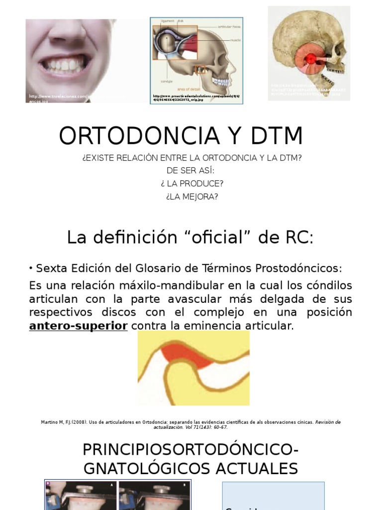 Reabsorción Condilar Progresiva o Idiopática | PDF | Anatomia animal ...