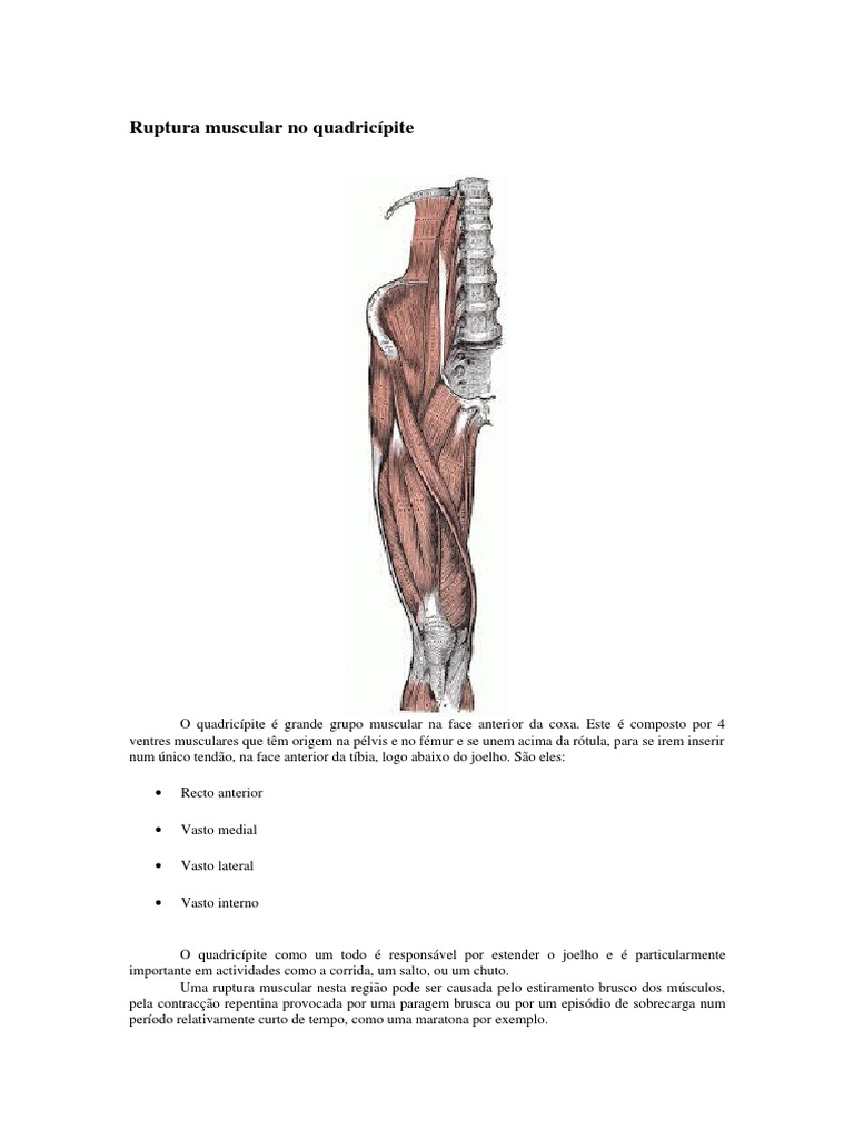 Ruptura Muscular No Quadricípite Músculo Flexibilidade (Anatomia