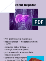 Cancerul Hepatic