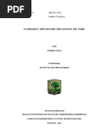 Download Gambaran Metastasis Keganasan Ke Paru by yandaoke SN255659818 doc pdf