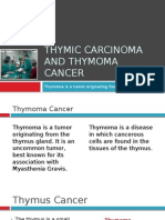 Thymoma and Thymic Carcinoma Best Surgical Treatment in Delih, India - Dr. (Prof.) Arvind Kumar