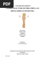 Download Closed Frakture Tibia Fibula d by AL Irawan SN255782752 doc pdf