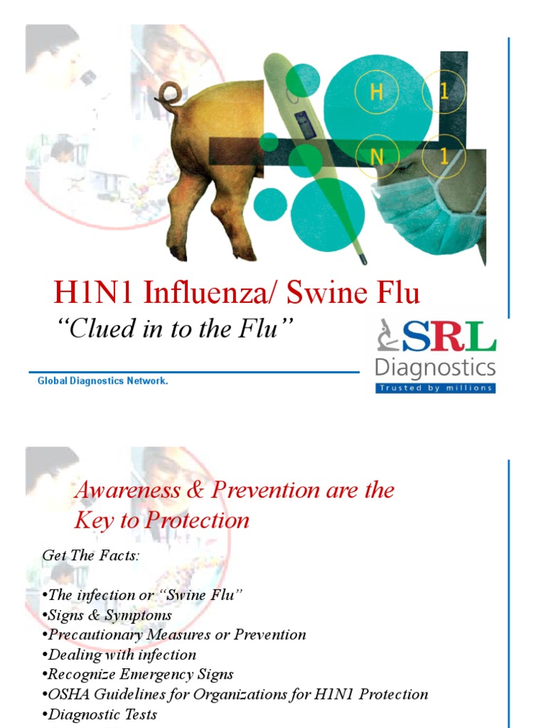 swine flu essay