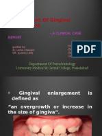 Gingival Hyperplasia