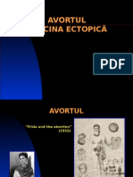 Ginecologie Curs 4 - Avortul. Sarcina Ectopica