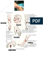 Heridas Abiertas