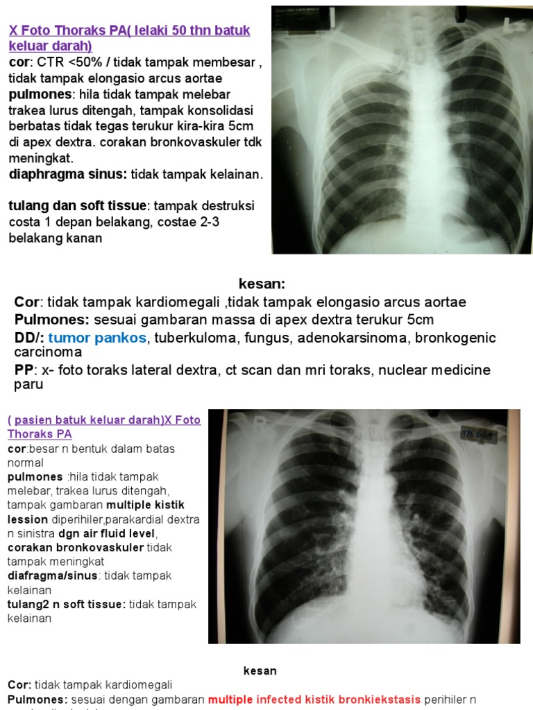 Radiology Study