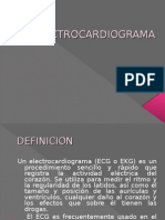 Electrocardiograma