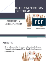 Enfermedades degenerativas óseas y articulares: Artritis y osteoporosis