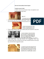 Indikasi Dan Kontraindikasi Dental Implant