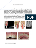 Fraktur Enamel Dentin Riwan