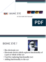 Bionic Eye: Hi-Tech Hope For The Blind