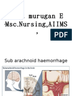 Balamurugan E,Subarachnoid hemorrhage.