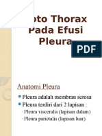 Foto Thorax Pada Efusi Pleura