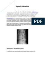 Spondylolisthesis PDF