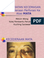 Kecederaan Mata