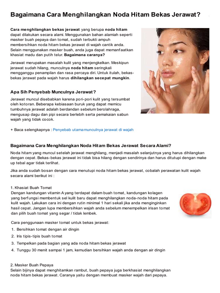 Tips Menghilangkan Bekas Jerawat Libre