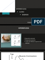 Términos Hiperreflexia, Clonus y Babinski