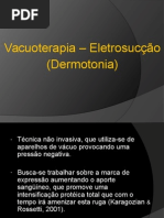 Vacuoterapia