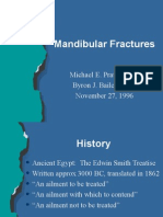 Mandibular Fracture