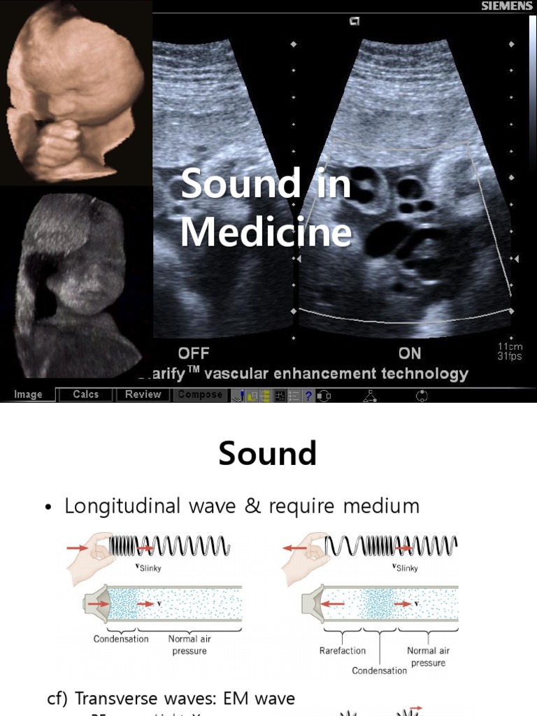 1__2__ Medical Ultrasound Attenuation