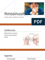 Rinosinusitis