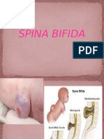 Spina Bifida