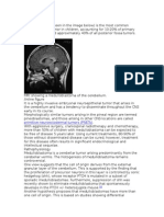 Medulloblastoma in Children: An Overview