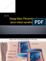 DVT