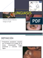 TUNGIASIS