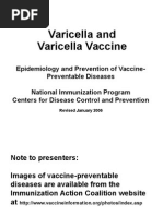 Varicella