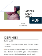 Campak 110702161653 Phpapp02