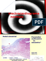 Electrocardiograma Normala: Ioana Stoian Propagarea Impulsului