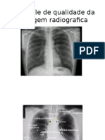 Controle de Qualidade Da Imagem Radiografica