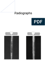 Radiographic Interpretation Graphs Guideline