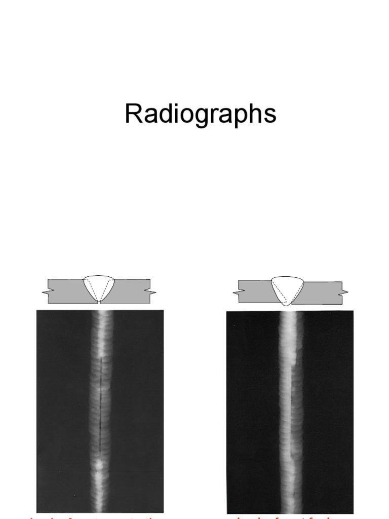 Radiographic Interpretation Graphs Guideline