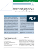fractura por flexocompresion cervicales.pdf