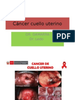 Cancer Cuello Uterino