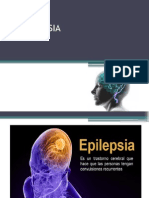 LA EPILEPSIA Diaposit Completa
