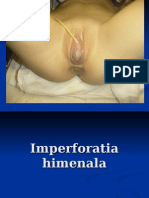 Imperforatia Himenala