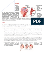 Qué Es Un Ataque o Derrame Cerebral