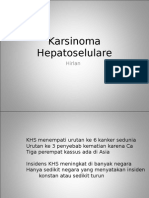 Hepatocellular Carcinoma