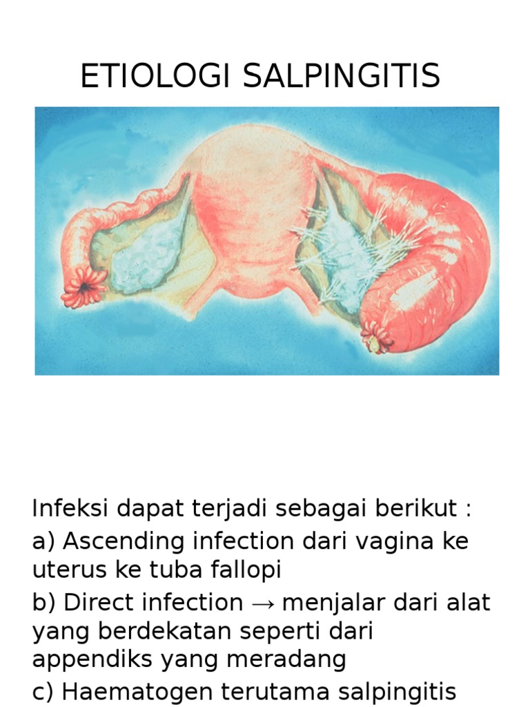 Etiologi dan Faktor Risiko Salpingitis | PDF | Ilmu Sosial