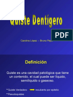 Quiste dentígero asociado a canino retenido