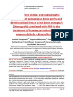 Comparative clinical and radiographic evaluation of autogenous bone grafts and demineralized freeze dried bone xenograft (Osseograft) combined with PRP in the treatment of human periodontal intra-osseous defects – 6 months study