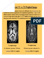 MRI T1 imaging vs T2 imaging