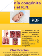 Neumonia Congenita 