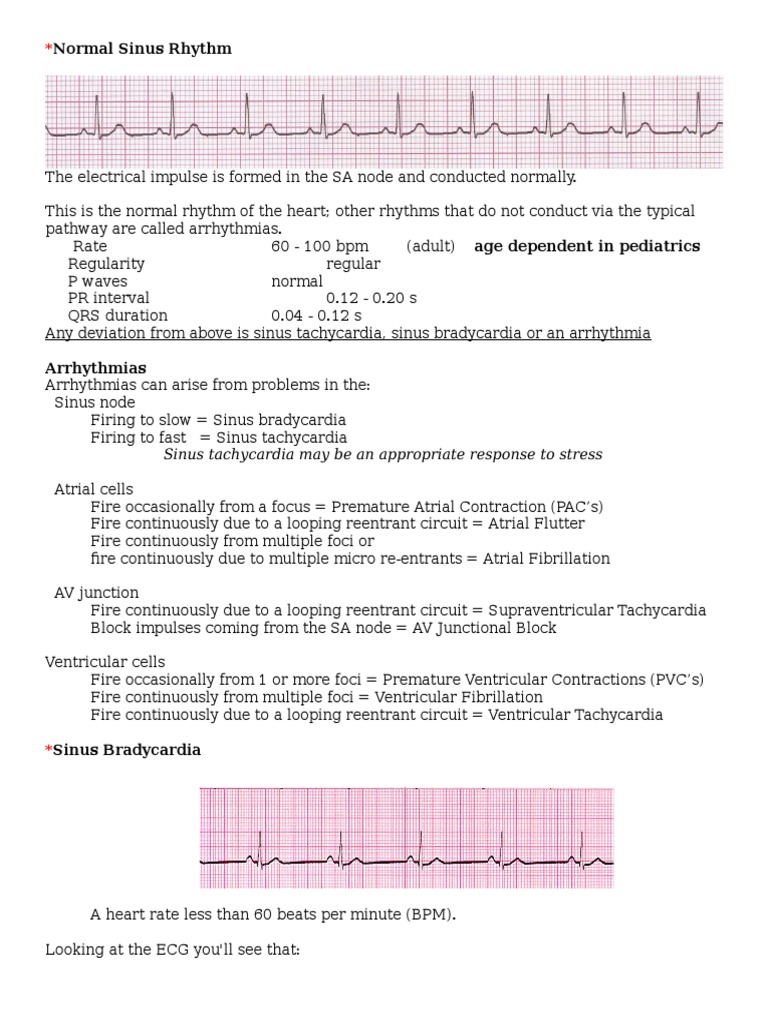 Rhythm Cardiac Arrhythmia Electrocardiography